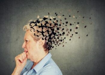 Alzheimer. Imagen referencial