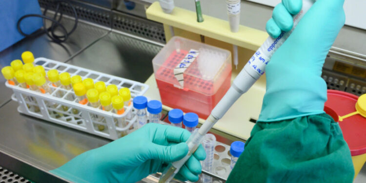 A staff member of the health authorities of the southern federal state of Baden-Wuerttemberg demonstrates on a negative sample the test for the coronavirus SARS-CoV-2, in a laboratory in Stuttgart, southern Germany, on March 2, 2020. - The death toll from the new coronavirus epidemic surpassed 3,000 on Monday, March 2, 2020, as more people died in China, Iran and the US and Europe raised its state of alert. EU president Ursula von der Leyen said the European Centre for Disease Prevention and Control (ECDC) had increased its risk assessment for Europeans after Italy's outbreak doubled in 48 hours. (Photo by THOMAS KIENZLE / AFP) (Photo by THOMAS KIENZLE/AFP via Getty Images)