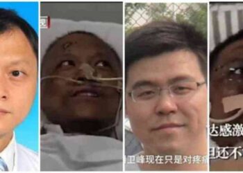 Problema hepático por Covid-19 causa ennegrecimiento a dos médicos chinos. Foto AS.com.