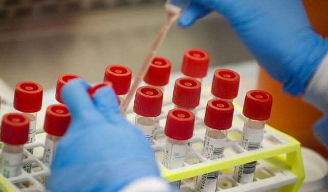 A laboratory technician prepares COVID-19 patient samples for semi-automatic testing at Northwell Health Labs, Wednesday, March 11, 2020, in Lake Success, N.Y. The US Food and Drug Administration has approved faster testing protocols as the viral outbreak continues to spread worldwide. For most people, the new coronavirus causes only mild or moderate symptoms. For some it can cause more severe illness. (AP Photo/John Minchillo)