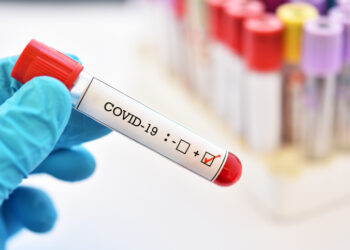 Blood sample tube positive with COVID-19 or novel coronavirus 2019 found in Wuhan, China