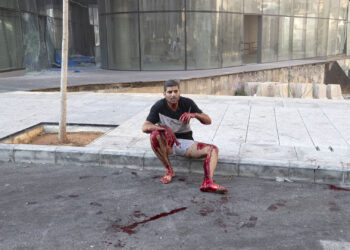 A wounded man sits on a sidewalk after a massive explosion in in Beirut, Lebanon, Tuesday, Aug. 4, 2020. Massive explosions rocked downtown Beirut on Tuesday, flattening much of the port, damaging buildings and blowing out windows and doors as a giant mushroom cloud rose above the capital. Witnesses saw many people injured by flying glass and debris. (AP Photo/Hassan Ammar)